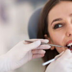 Dental Bonding