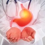 Gastroesophageal Reflux Disease
