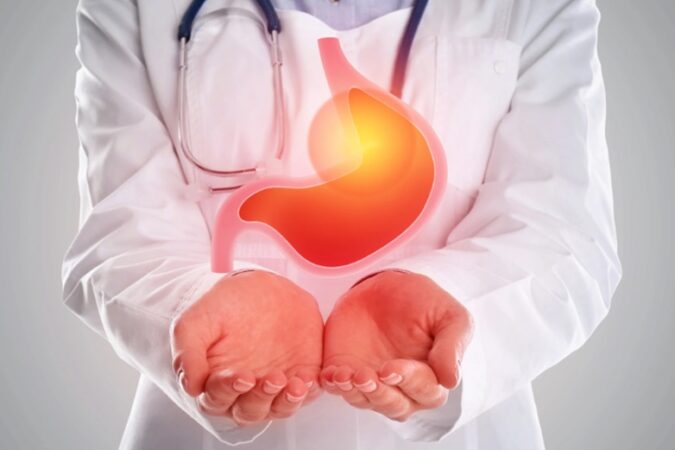 Gastroesophageal Reflux Disease