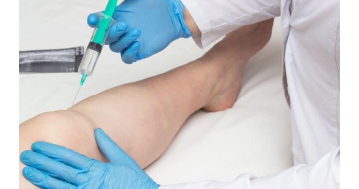 Joint Pain Treatments
