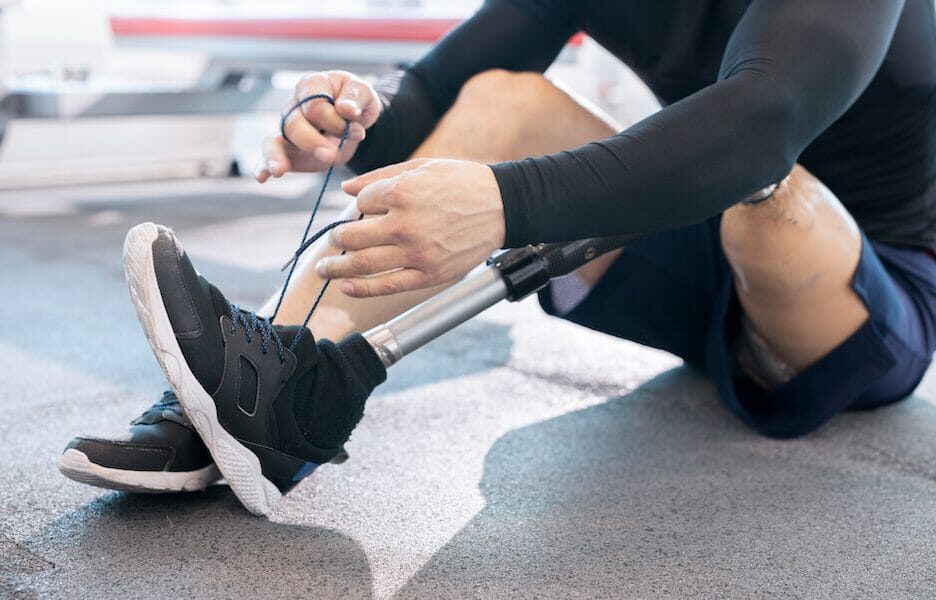 Prosthetic Ankles