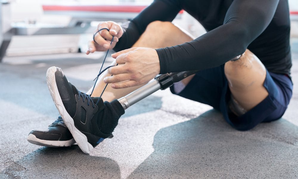 Prosthetic Ankles